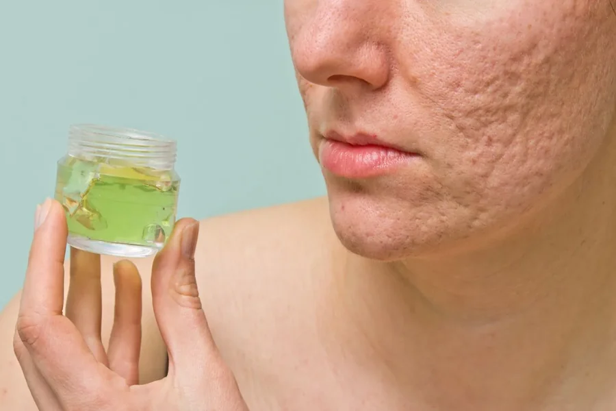 5 Major Skin Issues